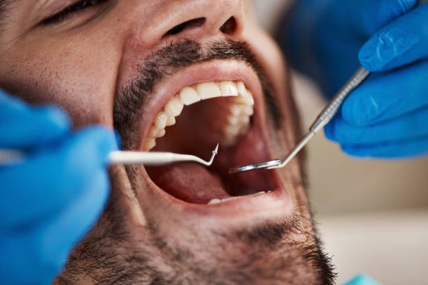 Best Emergency Denture Repair in Stanton, MI