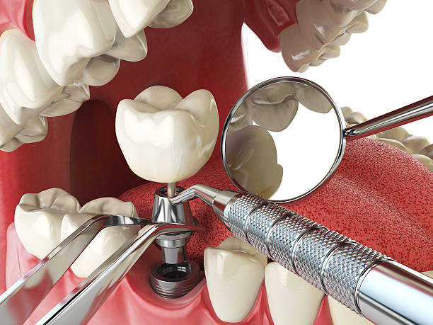 Best 24-Hour Emergency Dental Care in Stanton, MI